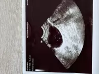 Виктория, изображение к комментарию.